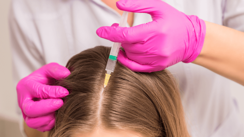 Exosome for hair