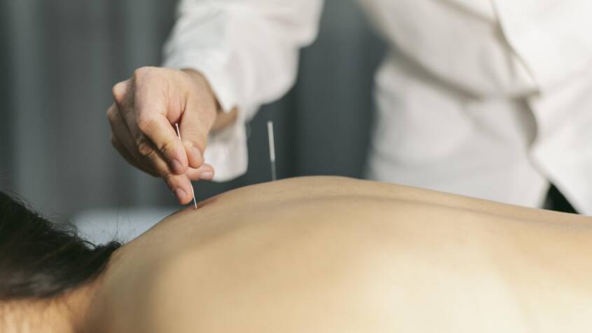 acupuncture in Calgary
